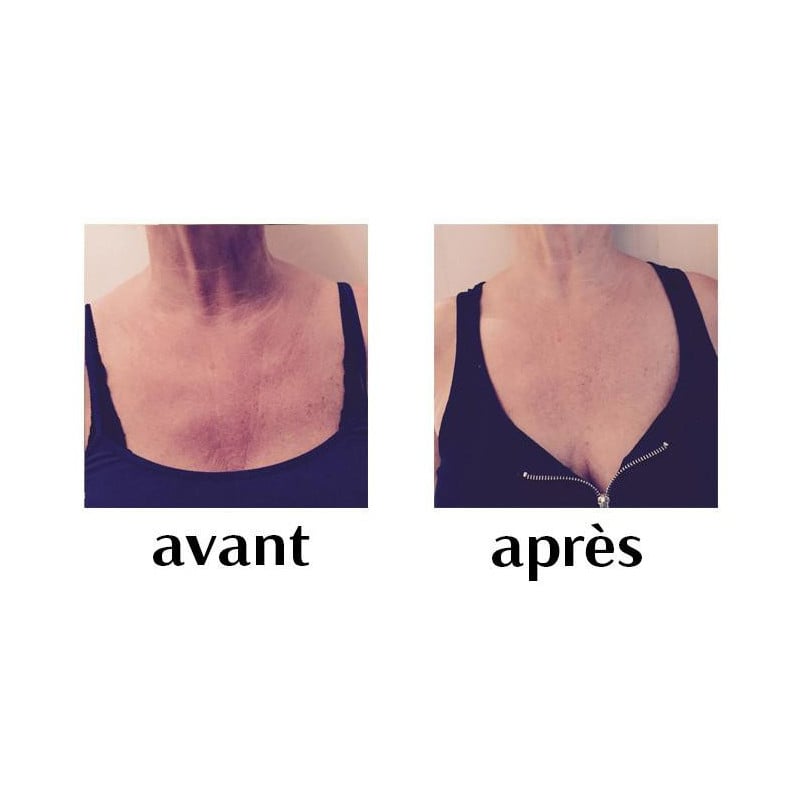 Patch Anti-Rides Décolleté - Crèmes volume poitrine pour travesti