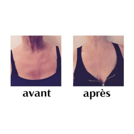 Patch Anti-Rides Décolleté - Crèmes volume poitrine pour travesti Patch Anti-Rides Décolleté - Crèmes volume poitrine pour travesti